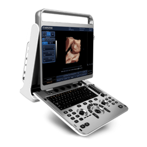 Chison EBit30 Ultrasound Machine