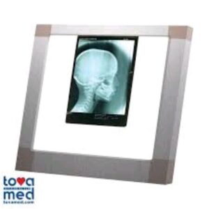 Hospital Medical Film Viewer