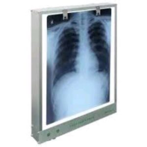 X-ray Viewer View Box