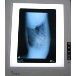 Single X-ray View Box