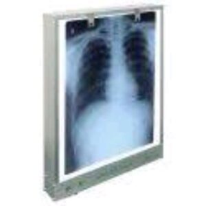 X-ray Viewer Machine