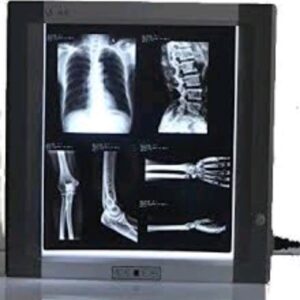 X-ray View Box