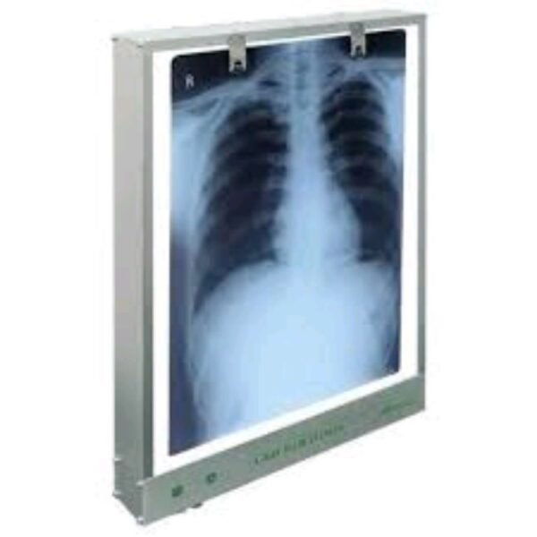 Medical Clinic X-ray View Box