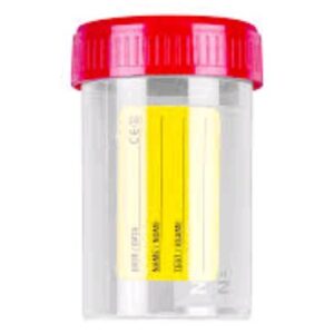 Hospital Urine Container