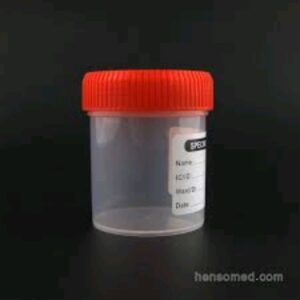 Plastic Urine Container