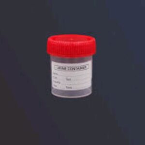 60ml Urine Container 400pcs