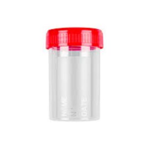 Medical Plastic Urine Container 400pcs