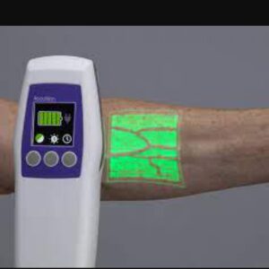 Vascular image vain finder