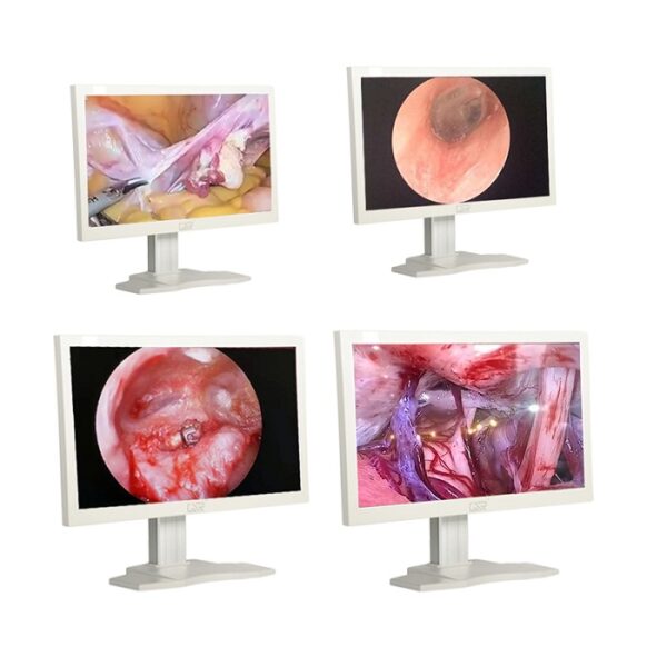 HD Medical Monitor ? GeiWre