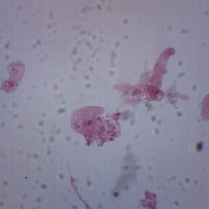 Amoeba Proteus, Whole Mount ? Prepared Microscope Slide
